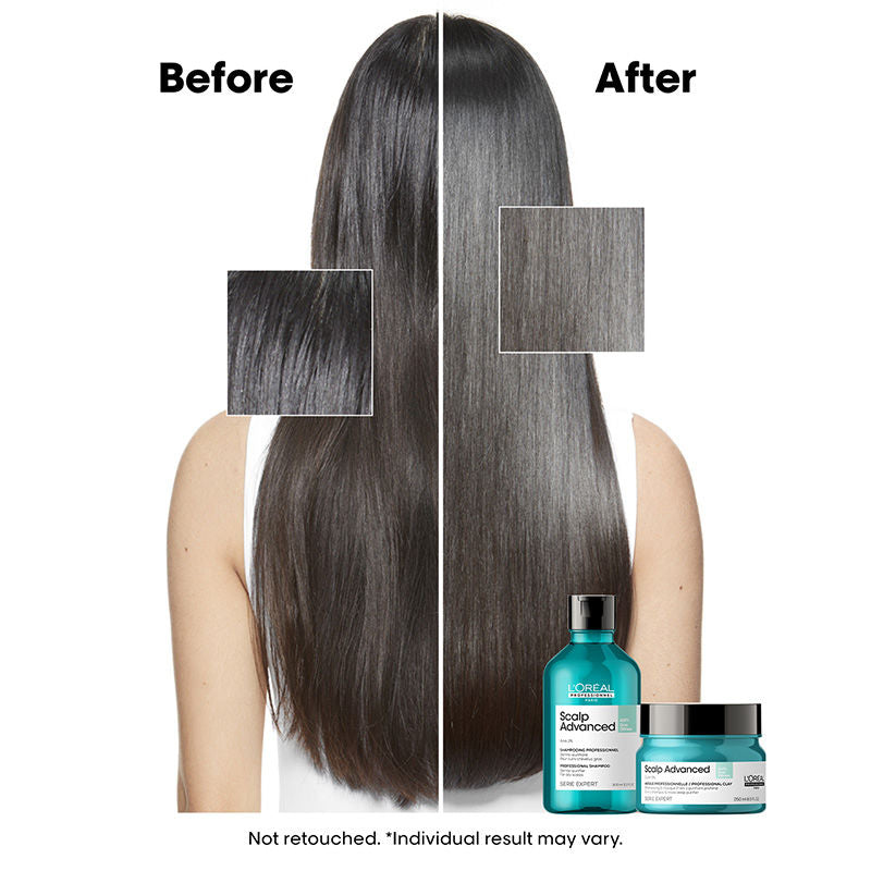L'Oréal Professionnel Scalp Advanced Anti-Oiliness 2-In-1 Shampoo & Mask for Very Oily Scalp – photo 3