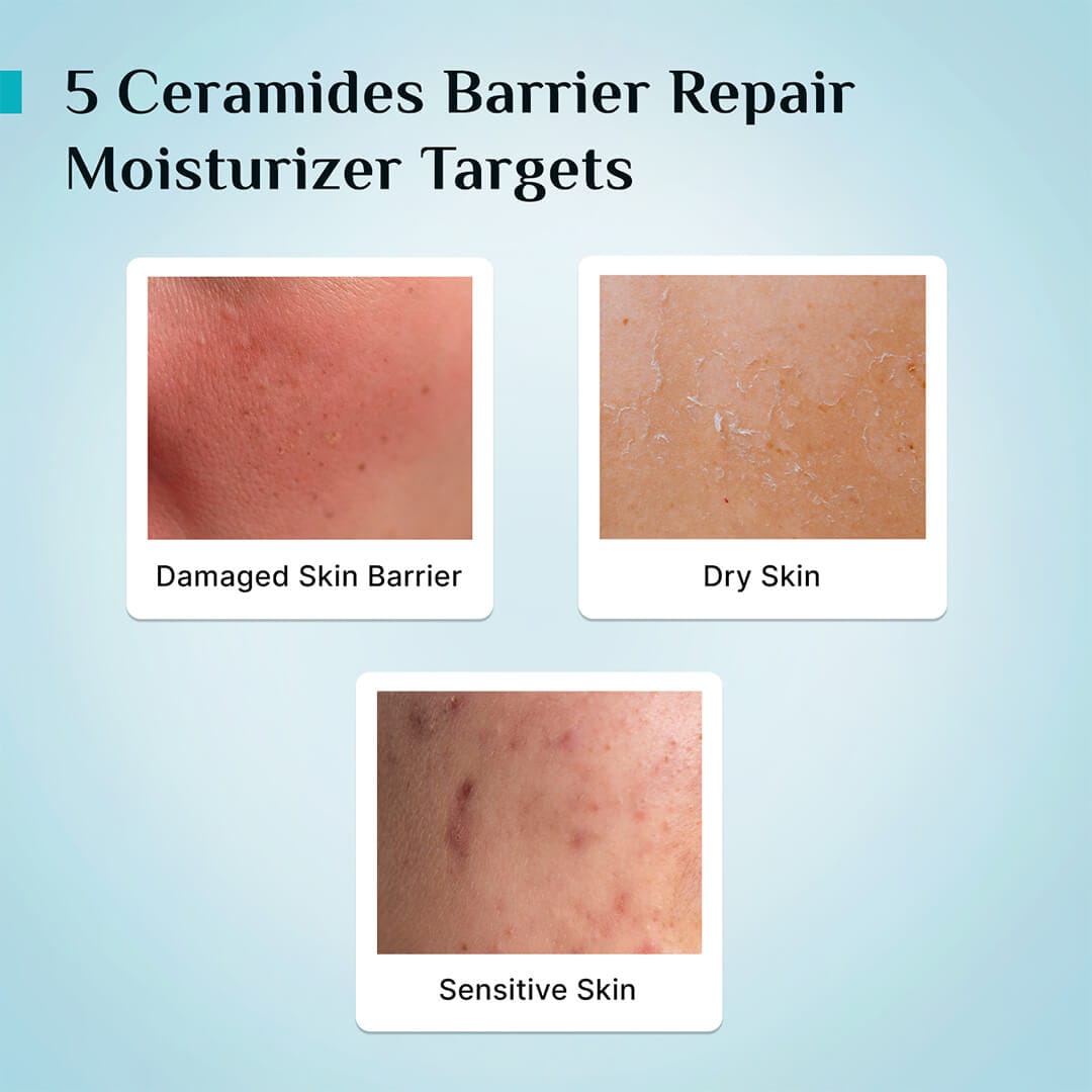 Pilgrim 5 Ceramides Barrier Repair Moisturizer with Korean CICA - 100g – photo 6