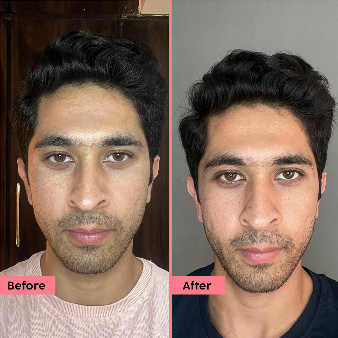 Plix Overnight Serum – photo 4