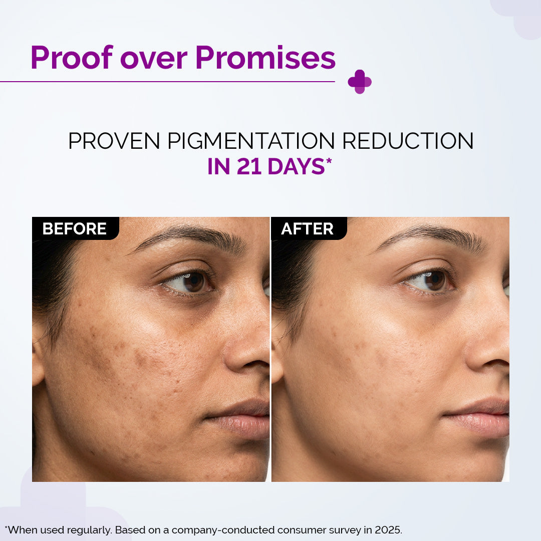 The Derma Co 2% Kojic Acid Face Serum with 1% Alpha Arbutin & Niacinamide (30 ml) – photo 3