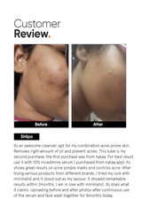 Minimalist Salicylic Acid + LHA 2% Face Cleanser