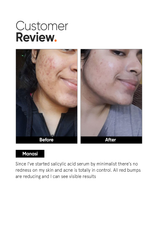 Minimalist Salicylic Acid 2% Face Serum