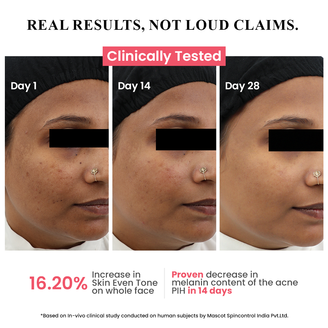 ClayCo Hyperpigmentation Mushroom Serum (30 ml) – photo 3