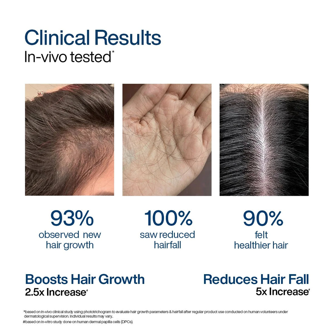 WishCare Hair Growth Serum Concentrate with Redensyl, Anagain, Baicapil & Rosemary (30 ml) – image 3